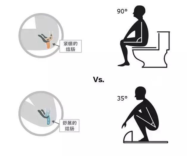 上廁所