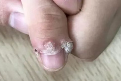 手指頭